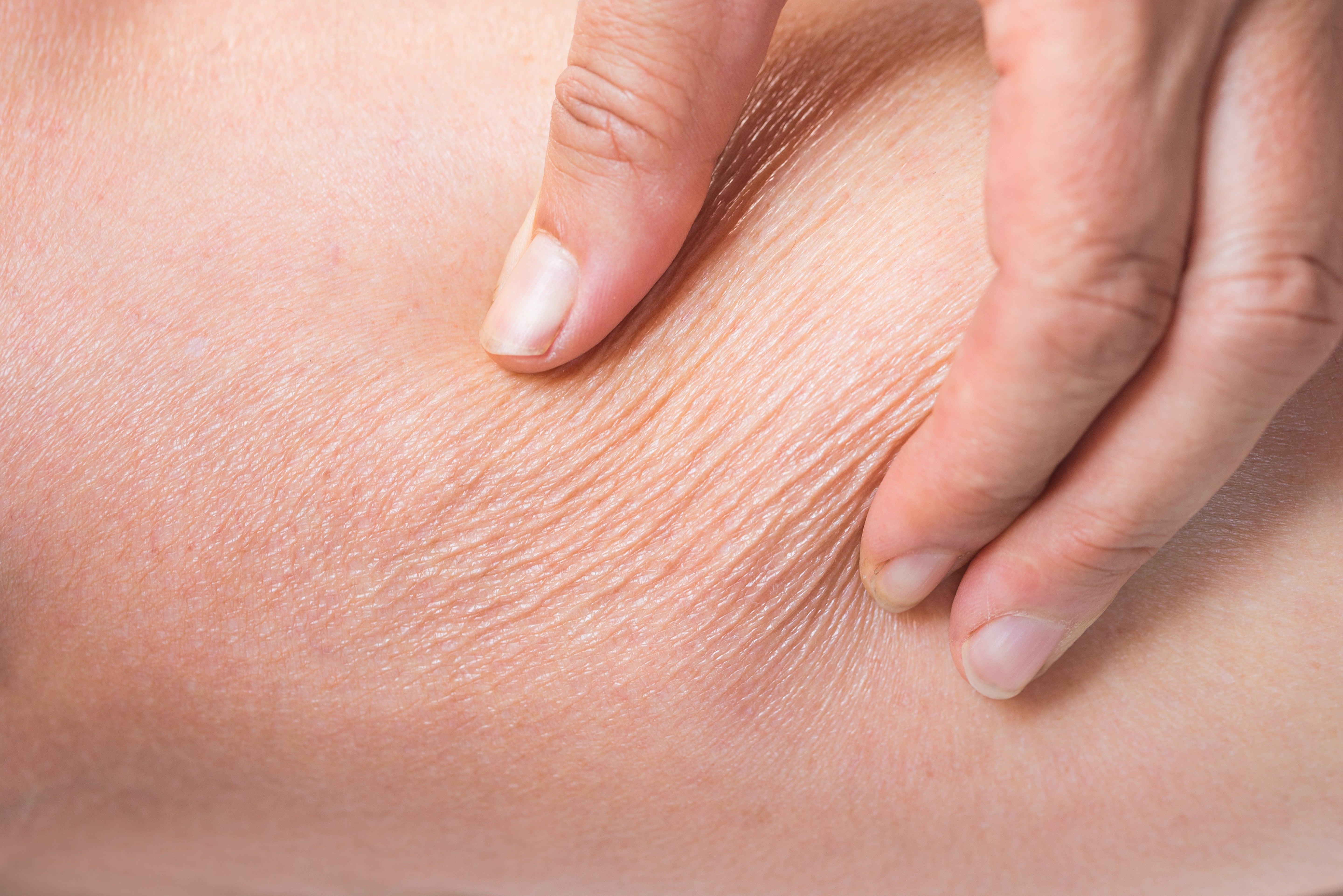 How to remedy a rough and dull winter skin